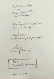 hepatocellular carcinoma