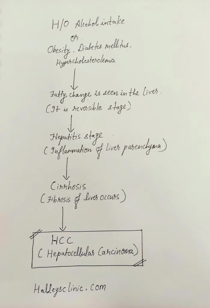 hepatocellular carcinoma disease progressionhalleys clinic